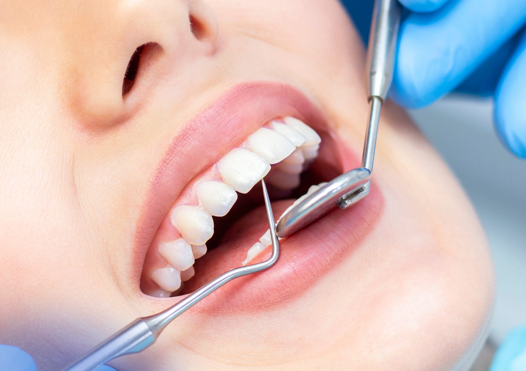 Get Back to Smiling with Our Restorative Dentistry Services